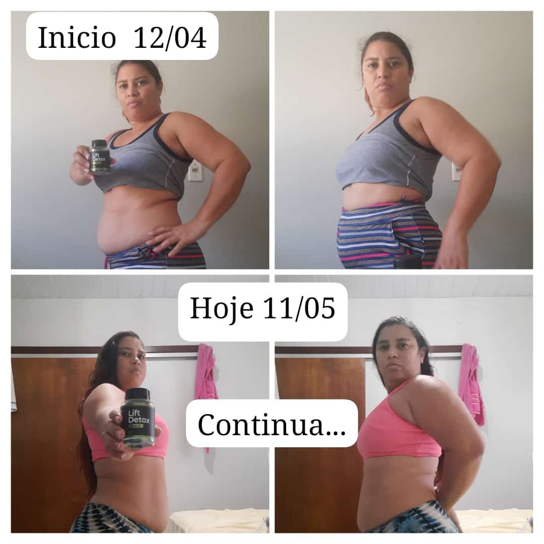 imagem lift detox black original antes e depois