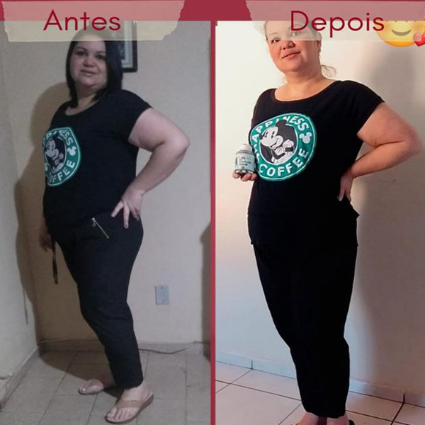 Lift Detox Black: 3ª imagem antes e depois de tomar as cápsulas!