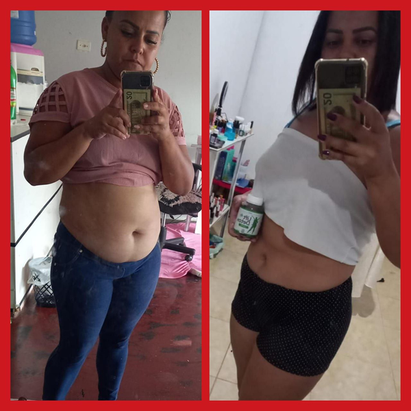 4ª- imagem: depoimento antes e depois lift detox.